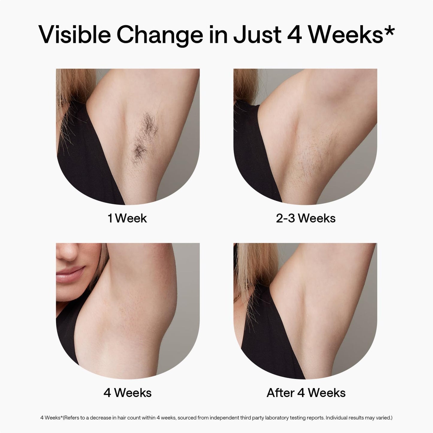 25% voucher applied at checkout, valid until 31st March, IPL Hair Removal, Ulike Air 2 Patented Sapphire Ice Cooling Technology Hair Removal Device for Truely Painless Hair Removal, from Face to Toes IPL Hair Remover for Women, Dark Green