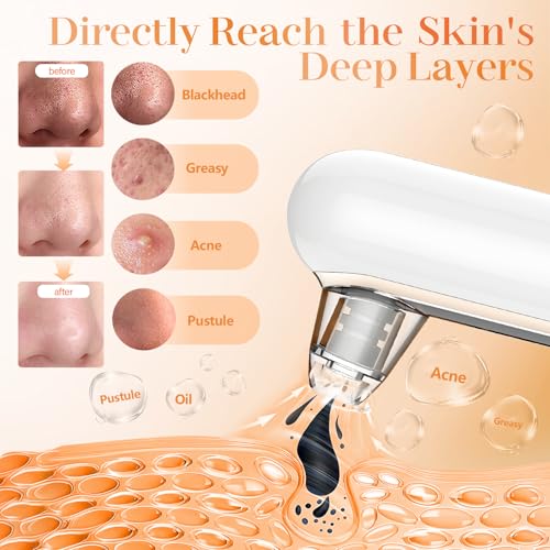 20% voucher applied at checkout, valid until 20th March,  Blackhead Remover Vacuum 4 Suction Power Mode Blackhead Remover Tool Rechargeable Black Head Remover for Face with 4 Suction Heads Pore Vacuum Cleaner Acne Pimple Whitehead Extractor